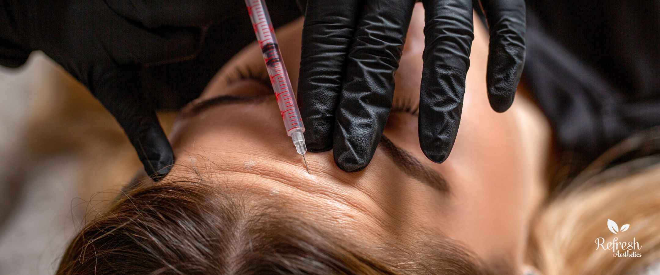 Botox Treatment at Refresh Aesthetics in Roosevelt Utah Botox Injection, Refresh Aesthetics