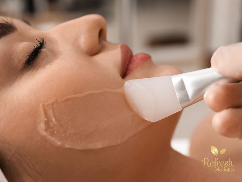 pic-image-chemical-peels3 Botox Injections