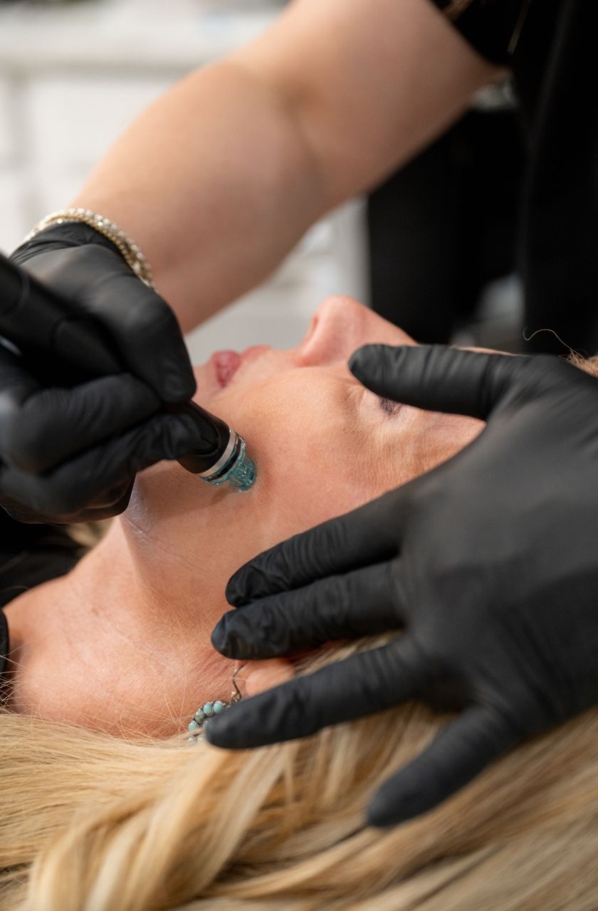 pic-image-hydrafacial-refresh2 Botox Treatment