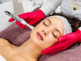 pic-image-refresh-Microneedling