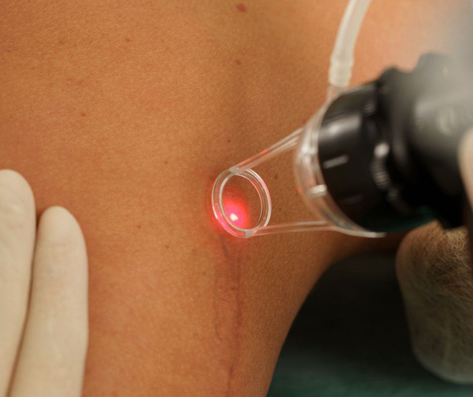 med spa skin resurfacing
