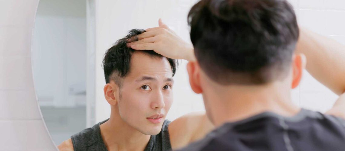 man looking at receding hair line in the mirror