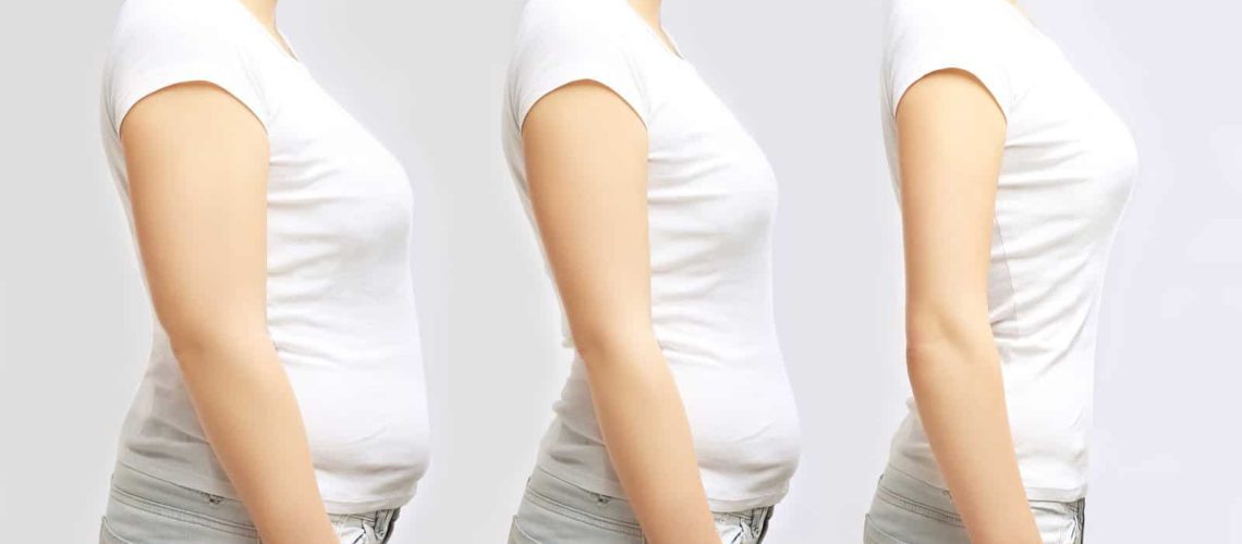 medically supervised weight loss
